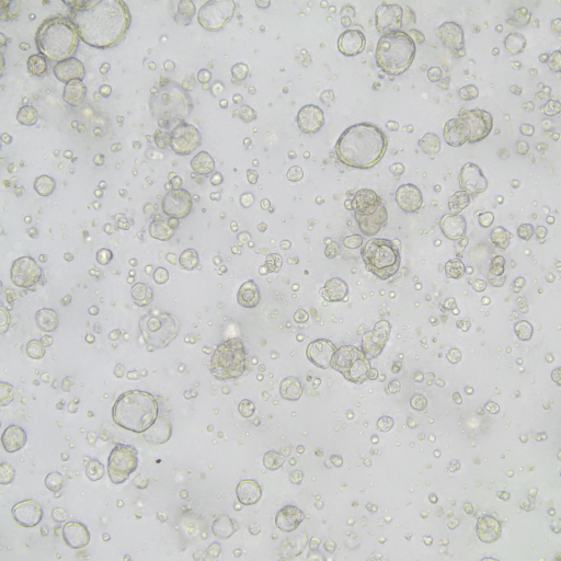 Organoid BioBank